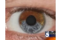 Каліфорнійський учений лазером змінює колір очей за 20 хвилин