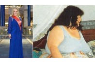 Жінка схудла на 130 кг від переляку за своє життя