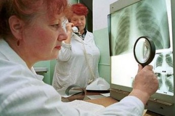 За минулий рік у Луцьку зафіксували лише один випадок захворювання дітей на  туберкульоз