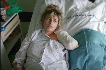 Українці, яка втратила руку у Польщі, потрібні гроші на лікування (фото 18+)
