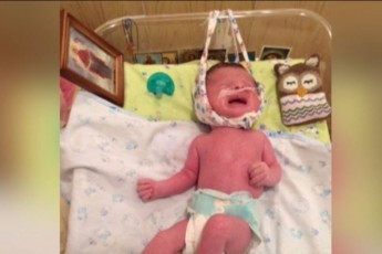 Хмельничанка доводить провину лікарів в інвалідності її новонародженого сина