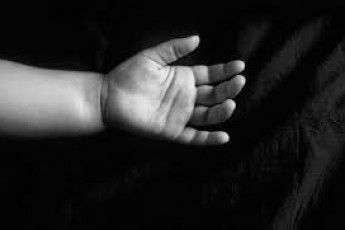 В Україні через кір померло немовля, якому було 25 днів