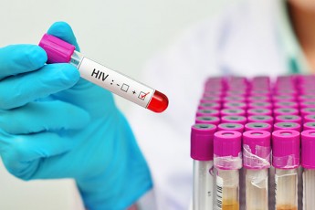 Зброя проти ВІЛ: вченим вдалося вперше знищити вірус
