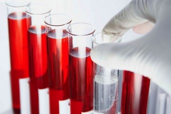 Вчені назвали групу крові, з якою люди живуть найдовше