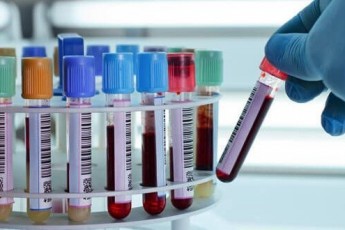 Новий аналіз крові точно визначає понад 20 типів раку