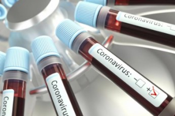 Україна отримає експрес-тести для виявлення коронавірусу за 15 хвилин
