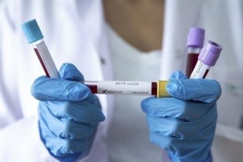 З'явилися нові дані щодо коронавірусу в Україні