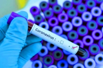 Волинська облрада просить місцеві ради виділити кошти на боротьбу з коронавірусом