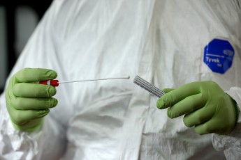 На Рівненщині зафіксували 9 випадків зараження на коронавірус, померла жінка