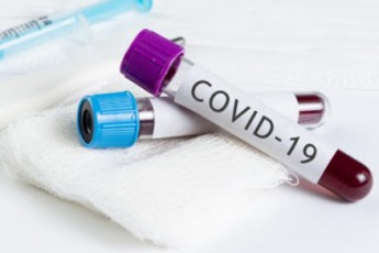 Коронавірус в Україні: нові дані поширення COVID-19