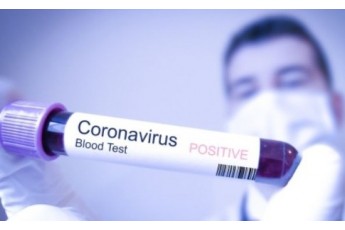 У селі на Волині виявили коронавірус: у жінки – ускладнена двобічна пневмонія