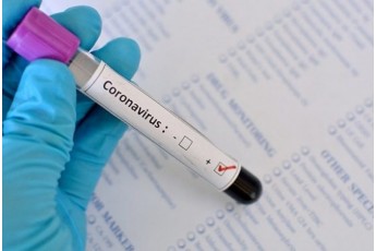 Мільйон тестів на добу: українців масово перевірятимуть на COVID-19
