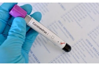 За добу у шести лучан виявили підозру на коронавірус