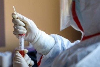 В Україні запровадили тестування на антитіла до коронавірусу