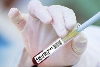Український штам коронавірусу відрізняється від китайського: що це означає