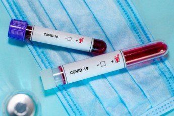На Волині за добу виявили 37 випадків інфікування коронавірусом, одна людина померла
