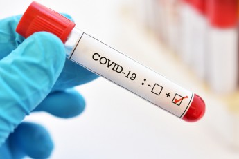 На Волині продовжує зростати кількість хворих коронавірусом, у Луцьку – найбільше