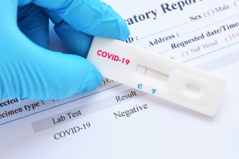Повідомили, хто може безкоштовно зробити тест на коронавірус на Волині