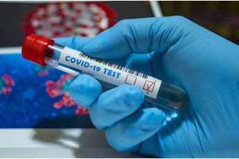 В Україні зафіксували понад 1600 нових випадків коронавірусу, на Волині – 85