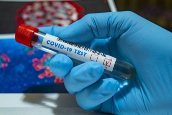В Україні додалося майже 2,5 тисяч хворих коронавірусом: статистика МОЗ на 14 вересня