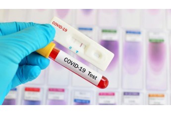 Україна встановила новий коронавірусний антирекорд: за добу виявили понад 3500 випадків