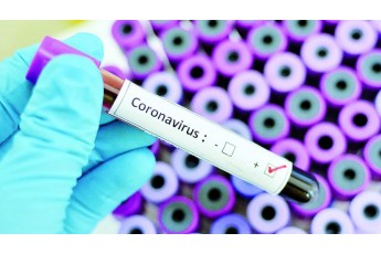За добу коронавірус виявили у 5 728 українців, на Волині – 154 випадки