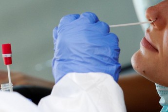 Лікар-епідеміолог пояснила, чи можуть помилятися тести на коронавірус