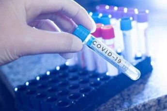 П'ять смертей за добу: на Волині продовжує стрімко зростати кількість хворих на коронавірус