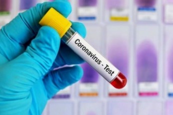 В Україні продовжує стрімко зростати кількість інфікованих COVID-19: за добу виявили понад 12 тисяч