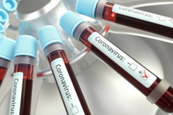 В Україні – майже 788 тисяч хворих на коронавірус: кількість інфікованих невпинно зростає