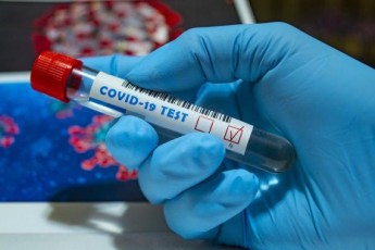 В Україні виявили понад 11 тисяч нових інфікованих коронавірусом, на Волині – 427