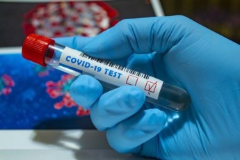 В Україні за добу виявили майже 10 тисяч хворих коронавірусом, на Волині – 281