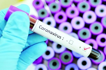 За добу в Україні виявили 5 334 нових хворих на коронавірус, на Волині – 86