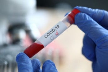 В Україні за добу виявили понад 8 тисяч нових хворих на коронавірус