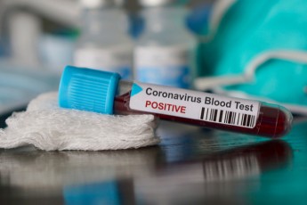 В Україні виявили більше, ніж три тисячі нових хворих на коронавірус