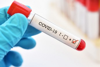 В Україні збільшилась кількість інфікованих коронавірусом