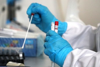 В Україні за добу виявили 5 336 випадків інфікування коронавірусом