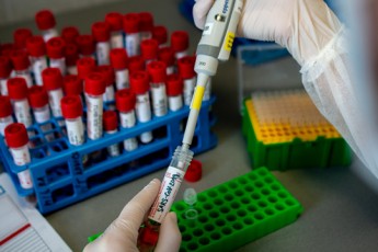 Коронавірус на Волині: скільки виявили нових хворих за добу