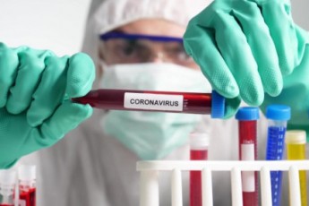 Вчені виявили новий штам коронавірусу, який не бачить ПЛР-тест