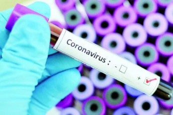 15 людей померли, 374 захворіли: де на Волині виявили коронавірус (статистика)