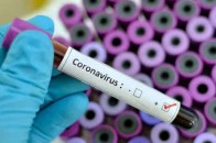 В Україні виявили 916 нових випадків захворювання на коронавірус