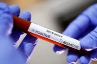 Тести на антитіла не визначають, чи людина має імунітет від коронавірусу
