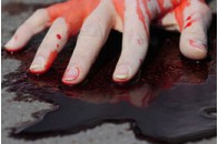 Сумщина: міліціонери до смерті побили інваліда
