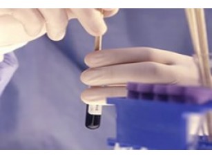 Наймолодшому депутату Луцької міськради Андрію Калахану потрібна термінова допомога