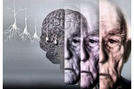 Учені створили революційні ліки від хвороби Альцгеймера