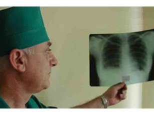 На Рівненщині зменшилася смертність від туберкульозу