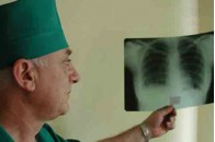 На Рівненщині зменшилася смертність від туберкульозу