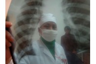 Туберкульозний диспансер у Луцьку переносити за межі міста не будуть