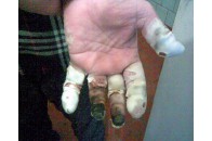 На Волині з’явилися перші жертви морозів