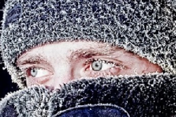 Дедалі більше волинян звертається до медиків з обмороженнями